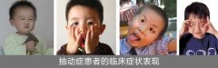 孩子挤眼睛是怎么回事？